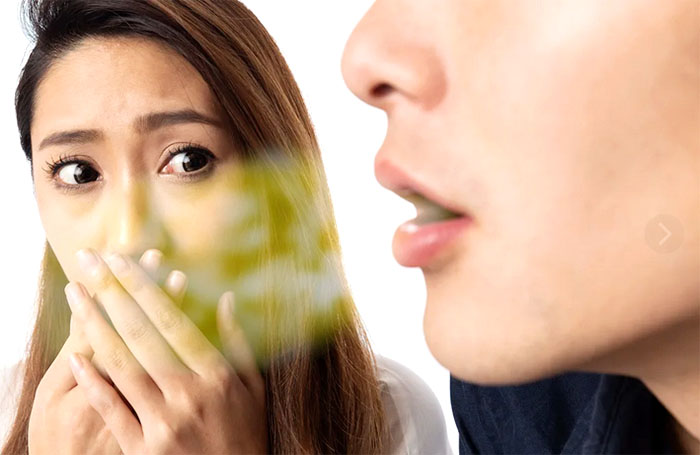 Kurang Percaya Diri Akibat Bau Mulut! Ini Cara Efektif Mendeteksi dan Mengatasi Bau Mulut