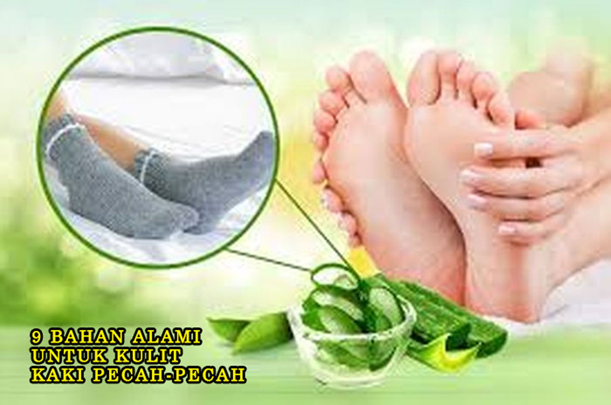 Memiliki Kulit Kaki Halus & Lembut? Ini 9 Bahan Alami untuk Kulit Kaki Pecah-Pecah, Nomor 1 Sering Dijumpai!