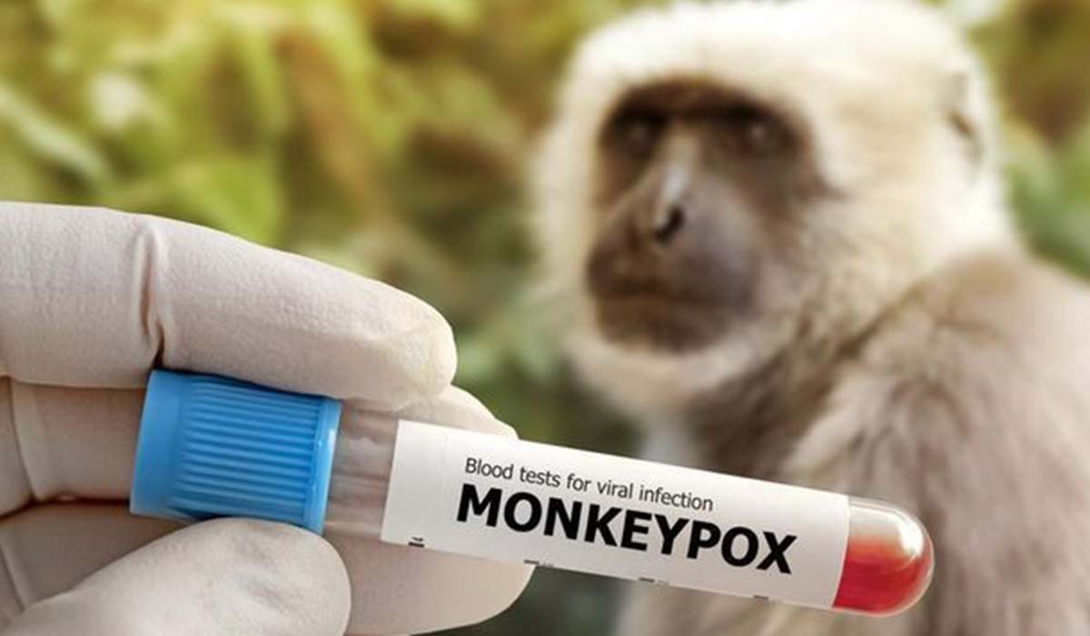 Waspada! Kemenkes Temukan Kasus Cacar Monyet di Jakarta, Tercatat Segini Jumlahnya di ASEAN