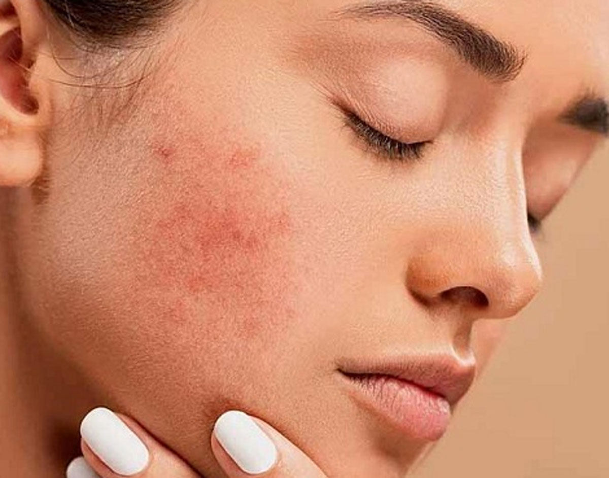 Bruntusan, Ketidakcocokan Skincare yang Perlu Diwaspadai