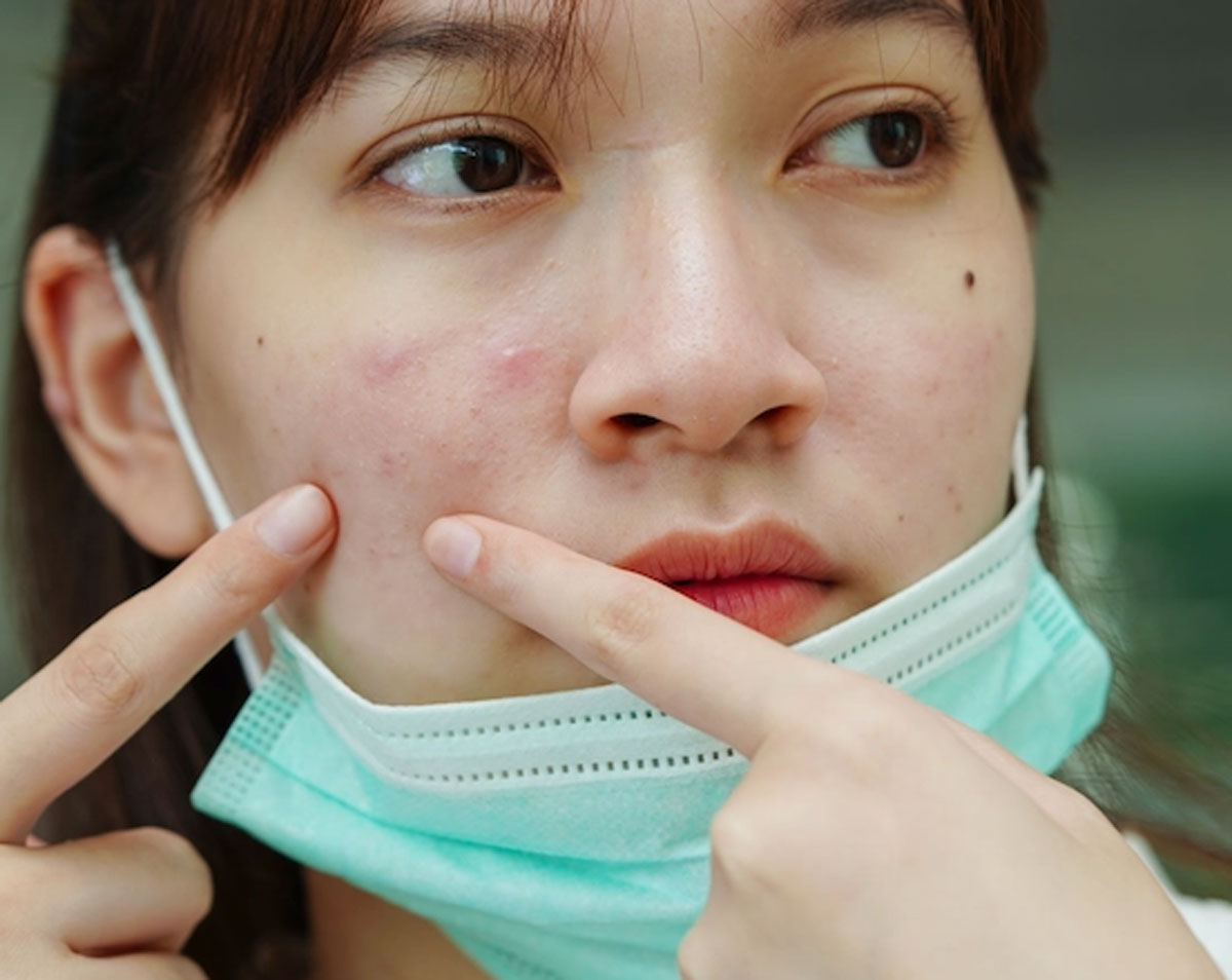 Rasa Gatal pada Kulit: Indikasi Reaksi Alergi Skincare yang Perlu Diwaspadai