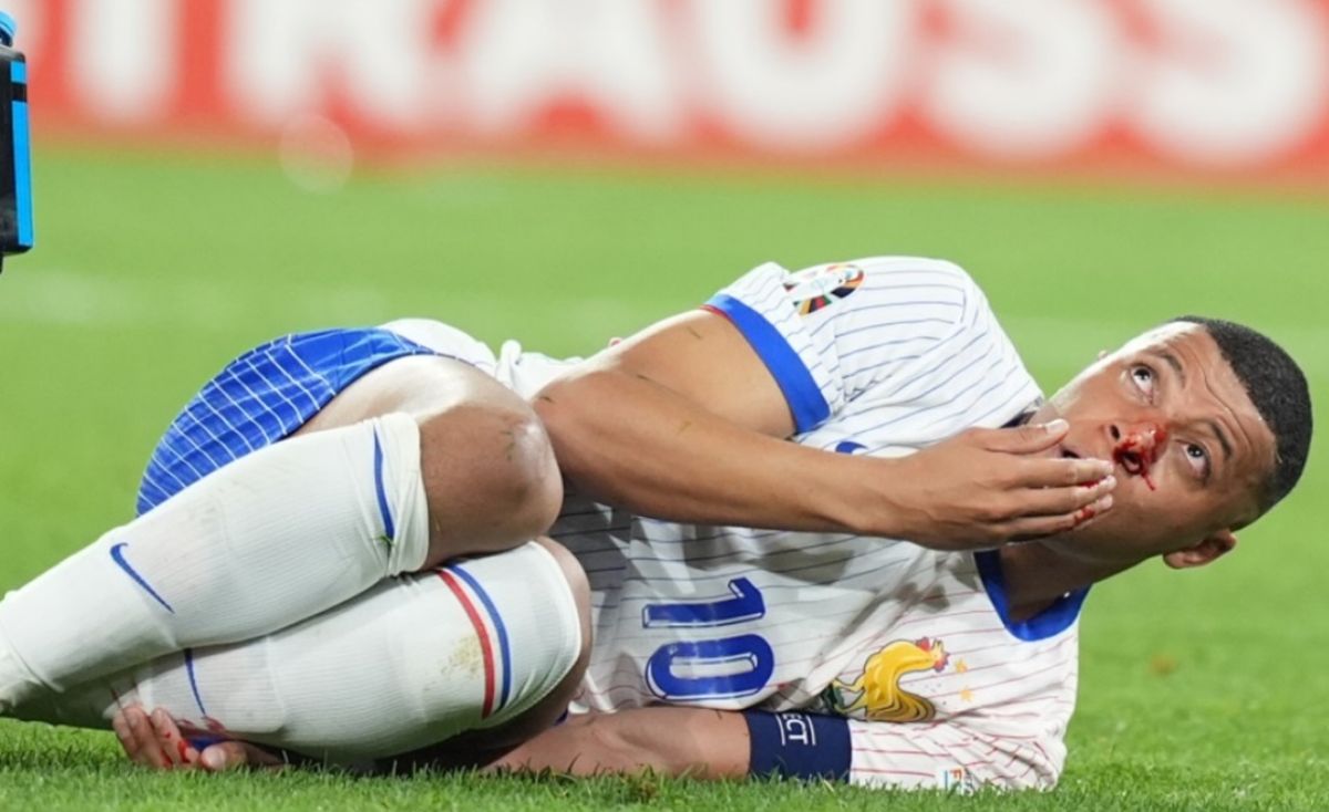 Intip Yuk! Drama Darah Mbappe: Prancis Menang Tipis 1-0 atas Austria dalam Euro 2024