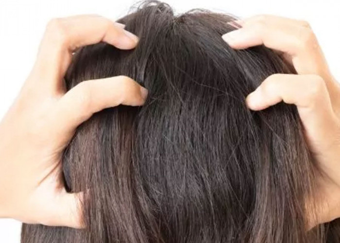 Waspada! Ini Kesalahan Perawatan yang Sering Bikin Dermatitis Seboroik Kambuh Lagi