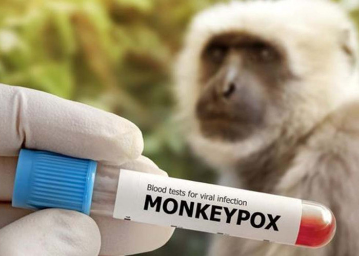 Waspada! Kemenkes Temukan Kasus Cacar Monyet di Jakarta, Tercatat Segini Jumlahnya di ASEAN