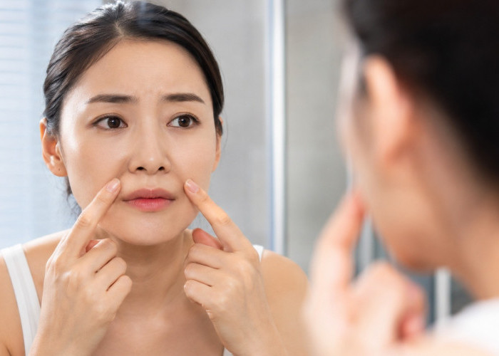 Belum 30 Tahun Sudah Punya Smile Lines? Simak Faktanya!