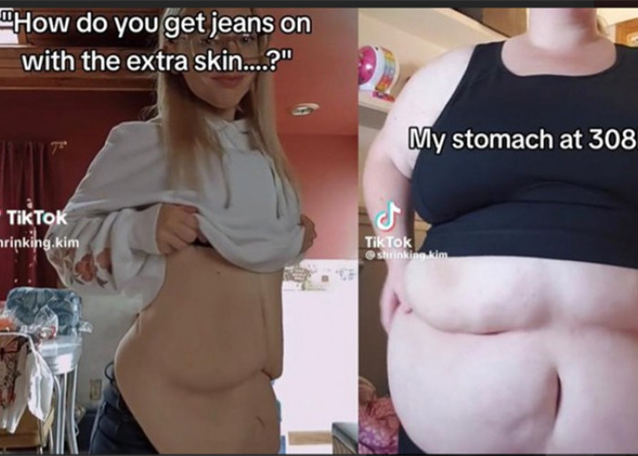Kisah Inspiratif Wanita Pennsylvania yang Berhasil Turun 80 kg Viral di Media Sosial