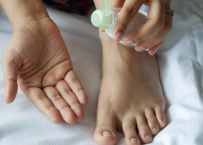 Pentingnya Mengatasi Kulit Kaki Kering dan Bersisik