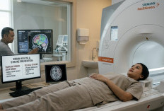 Masih Muda Tapi Kena Stroke? Cegah Sekarang Lewat Deteksi Dini MRI!